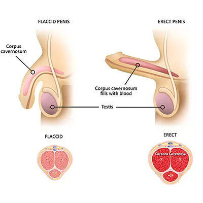 Erectile Dysfunction