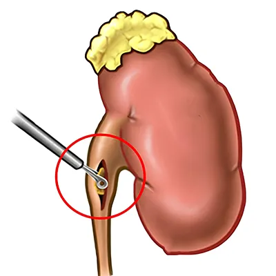 Laparoscopic Surgeon