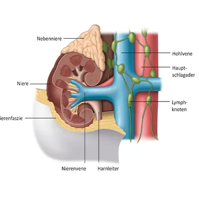 Radical Nephrectomy