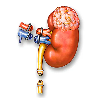 Robotic Radical Nephrectomy